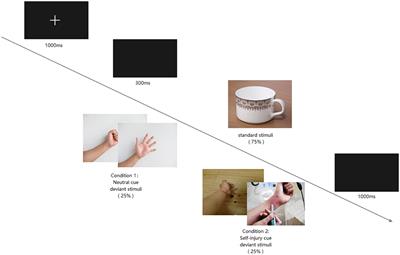 Impaired behavioral inhibitory control of self-injury cues between adolescents with depression with self-injury behavior and those without during a two-choice oddball task: an event-related potential study